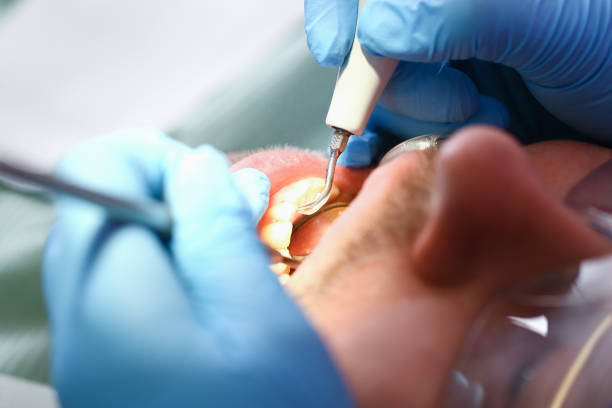 Best Urgent Dental Care for Toothache in Llington, MI