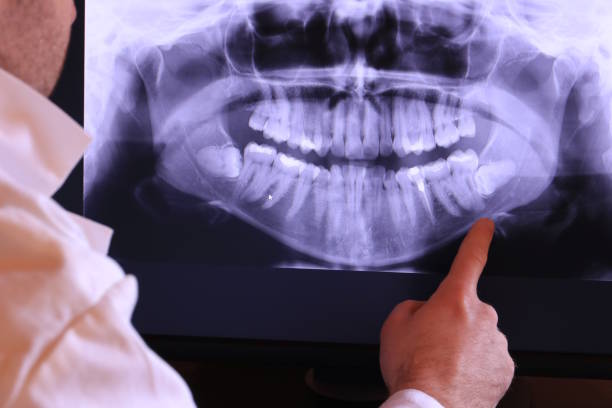 Best Pediatric Emergency Dentist in Llington, MI