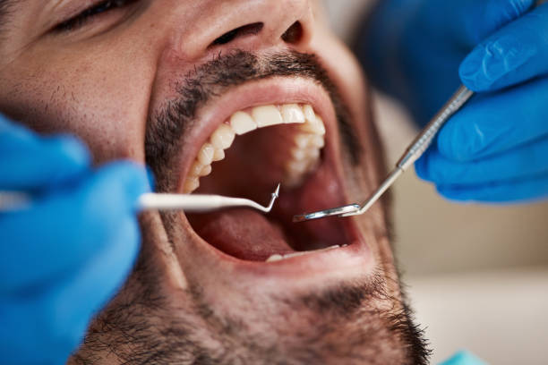 Best Emergency Dental Extractions in Llington, MI