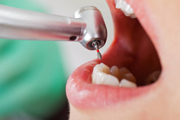 Best Emergency Dental Services for Seniors in Llington, MI